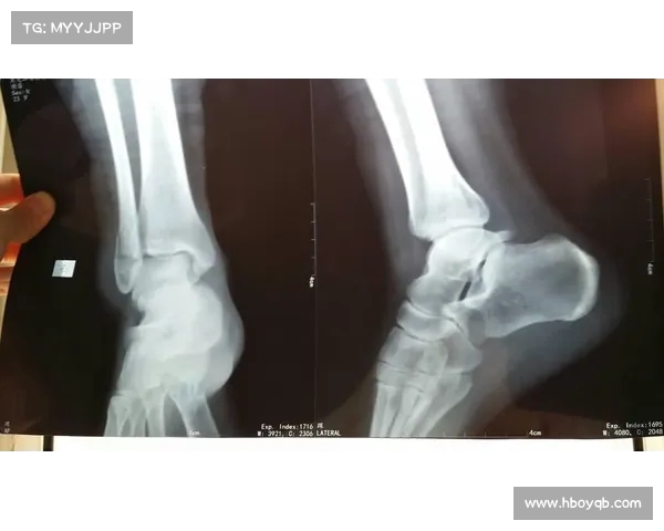 穆西亚拉疑似腓骨骨折紧急送医 担忧赛季报销情况分析 穆西亚拉疑似腓骨骨折紧急送医 担忧赛季报销情况分析